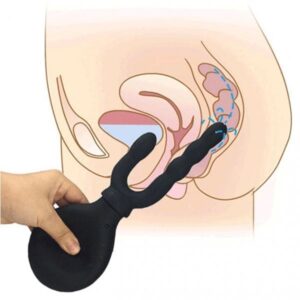 Анальний душ